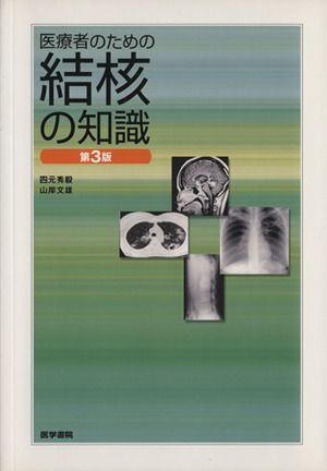 医療者のための結核の知識