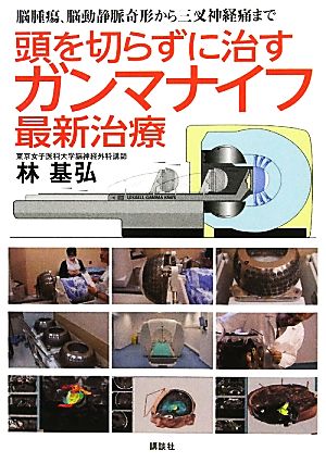 頭を切らずに治すガンマナイフ最新治療 脳腫瘍、脳動静脈奇形から三叉神経痛まで 健康ライブラリースペシャル