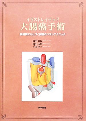 イラストレイテッド大腸癌手術 膜解剖にもとづく剥離のベストテクニック