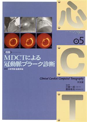 〈特集〉MDCTによる冠動脈プラーク診断(5)