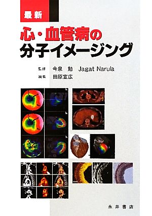 心・血管病の分子イメージング