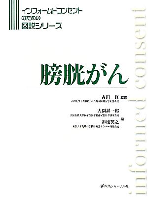 膀胱がん インフォームドコンセントのための図説シリーズ