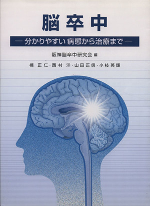 脳卒中 分かりやすい病態から治療まで