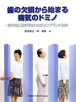 歯の欠損から始まる病気のドミノ 命の質と量を守るためのインプラント治療