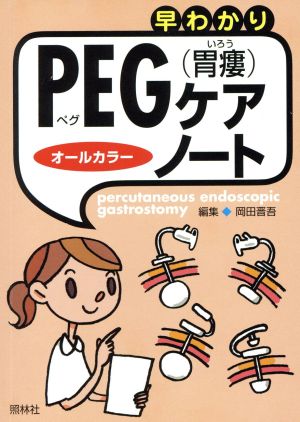 早わかりPEG(胃瘻)ケア・ノート オールカラー