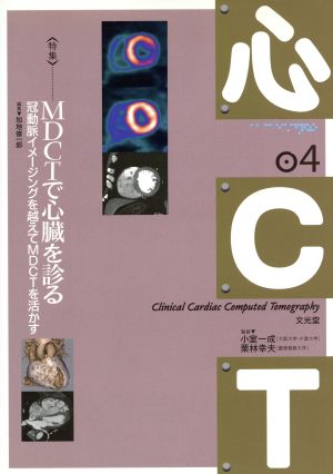 〈特集〉MDCTで心臓を診る 冠動脈イメージングを越えて