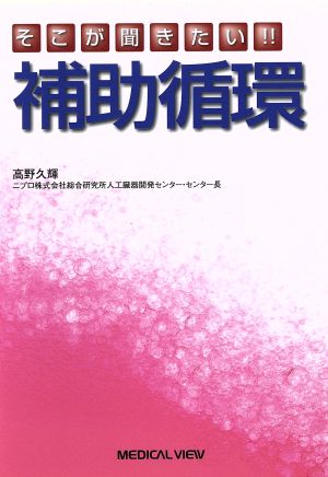 そこが聞きたい!!補助循環