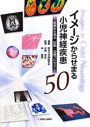 イメージからせまる小児神経疾患50 症例から学ぶ診断・治療プロセス