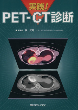 実践！ PET-CT診断
