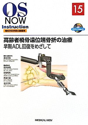 高齢者橈骨遠位端骨折の治療 早期ADL回復をめざして OS NOW Instruction整形外科手術の新標準15