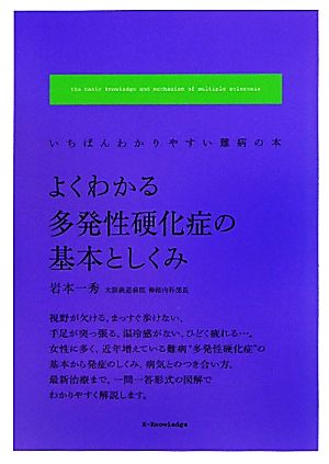 よくわかる多発性硬化症の基本としくみ いちばんわかりやすい難病の本