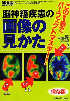 脳神経疾患の画像の見かた この1冊でパーフェクトマスター！