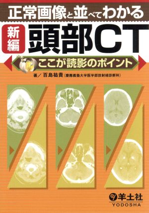 正常画像と並べてわかる新編頭部CT