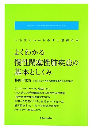 よくわかる慢性閉塞性肺疾患の基本としくみ いちばんわかりやすい難病の本