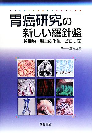 胃癌研究の新しい羅針盤 幹細胞・腸上皮化生・ピロリ菌