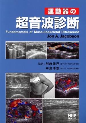 運動器の超音波診断