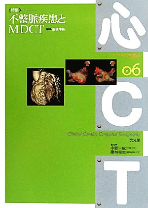 不整脈疾患とMDCT 心CT6