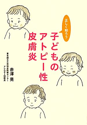 子どものアトピー性皮膚炎 正しく知ろう