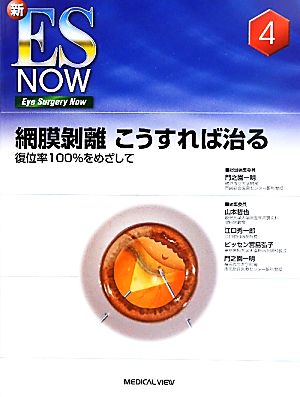 網膜剥離 こうすれば治る 復位率100%をめざして 新ES NOWNo.4