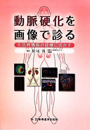 動脈硬化を画像で診る 生活習慣病の診療に活かす