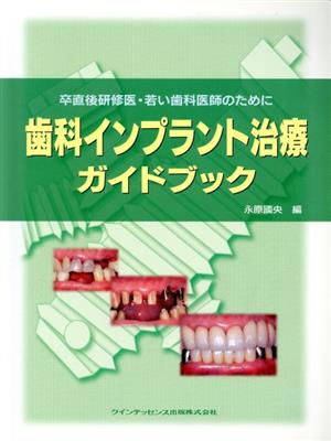 歯科インプラント治療ガイドブック 卒直後研修医・若い歯科医師