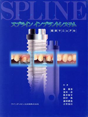 スプラインインプラントシステム臨床マニュアル