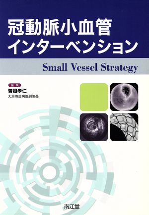 冠動脈小血管インターベンション Small Vessel Strategy