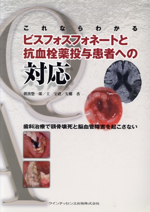 歯科医院で患者さんにしっかり説明できる本 このまま使えるDr.もDHも