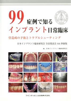 99症例で知るインプラント日常臨床 骨造成の予後とトラブルシューティング