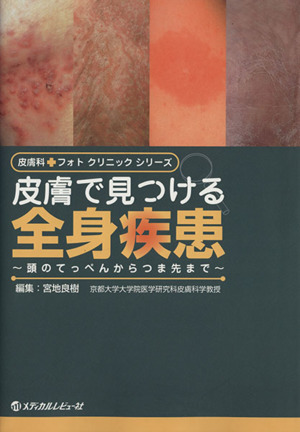 皮膚で見つける全身疾患 頭のてっぺんからつま先まで 皮膚科フォトクリニックシリーズ