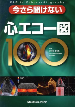 今さら聞けない心エコー図100