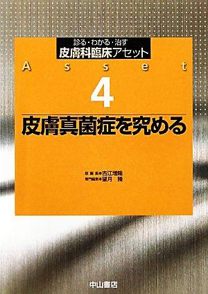 皮膚真菌症を究める 診る・わかる・治す 皮膚科臨床アセット4