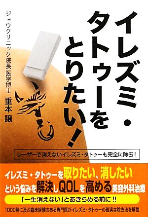 イレズミ・タトゥーをとりたい！