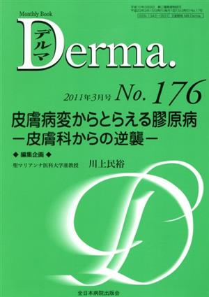 皮膚病変からとらえる膠原病 Monthly Book