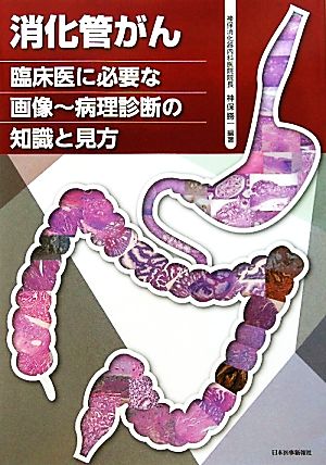 消化管がん 臨床医に必要な画像 病理診断の知識と見方