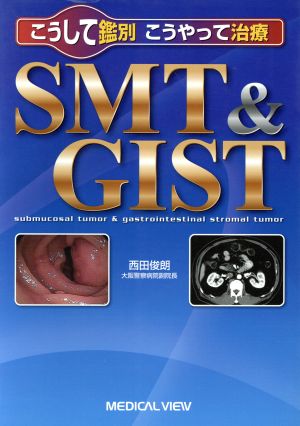 こうして鑑別、こうやって治療 SMT&GIST