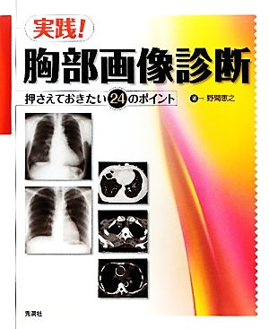 実践！胸部画像診断 押さえておきたい24のポイント