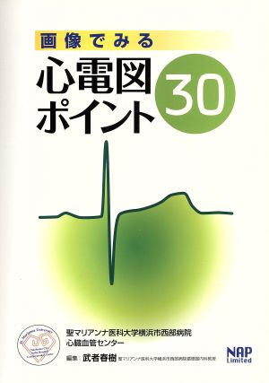 画像でみる心電図ポイント30