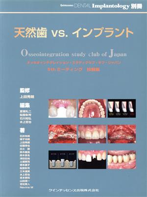 天然歯vs.インプラント オッセオインテグレイション・スタデ