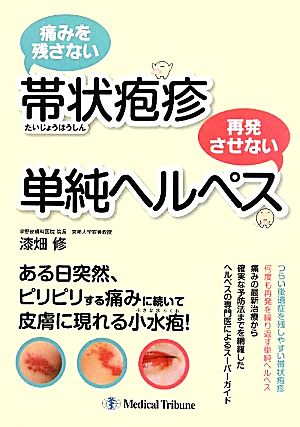 痛みを残さない帯状疱疹 再発させない単純ヘルペス