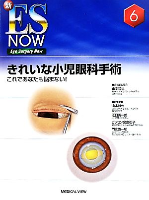 きれいな小児眼科手術 これであなたも悩まない！ 新ES NOWNo.6