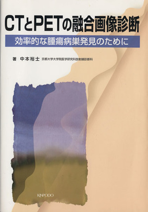 CTとPETの融合画像診断 効率的な腫瘍病巣発見のために