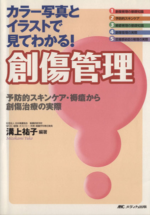 カラー写真とイラストで見てわかる！創傷管理 予防的スキンケア