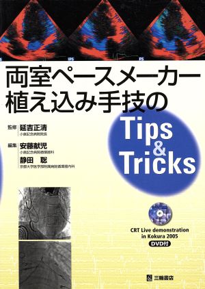 両室ペースメーカー植え込み手技のtips & tricks