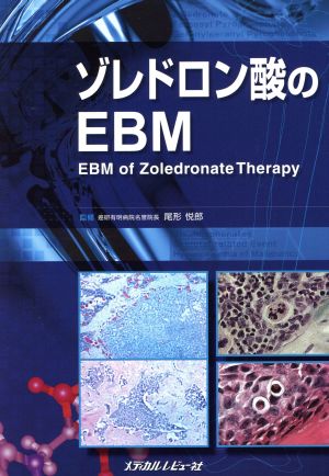 ゾレドロン酸のEBM