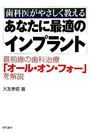 あなたに最適のインプラント 歯科医がやさしく教える 最前線の歯科治療「オール・オン・フォー」を解説