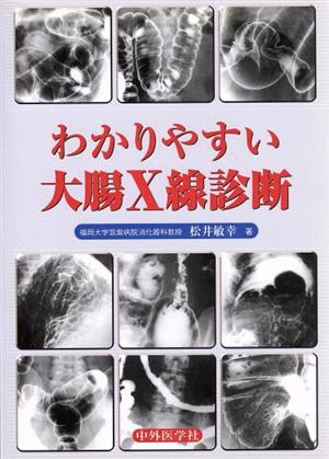 わかりやすい大腸X線診断