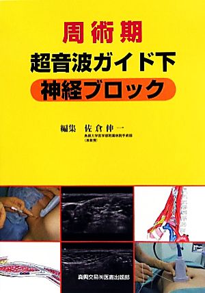 周術期超音波ガイド下神経ブロック