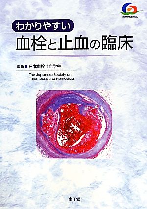 わかりやすい血栓と止血の臨床