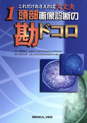 頭部画像診断の勘ドコロ